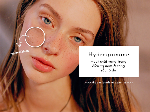 Hydroquinone: Hoạt chất làm trắng da mạnh nhất nhưng là con dao hai lưỡi nếu dùng sai cách